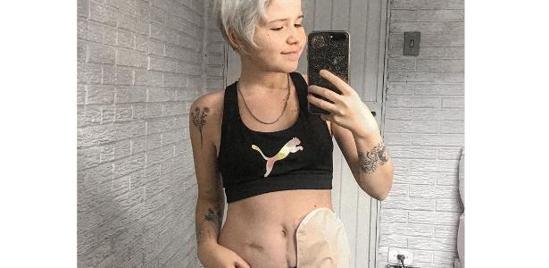 “Eu me escondi por 8 anos por medo de reação”, diz youtuber com bolsa de colostomia – 16/07/2020